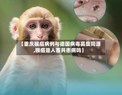 【重庆猴痘病例与德国病毒高度同源,猴痘是人畜共患病吗】