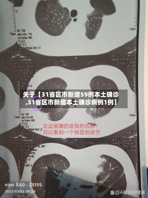 关于【31省区市新增59例本土确诊,31省区市新增本土确诊病例1例】