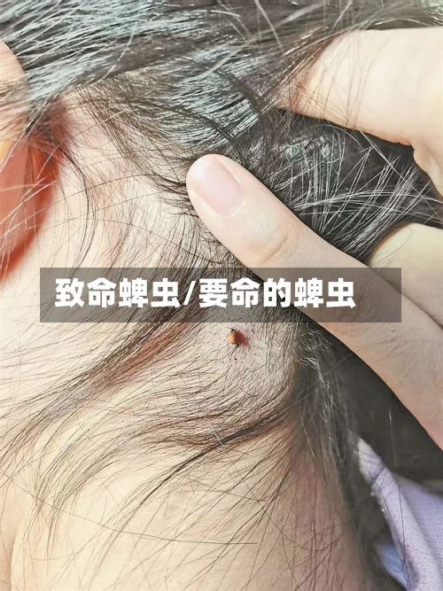 致命蜱虫/要命的蜱虫