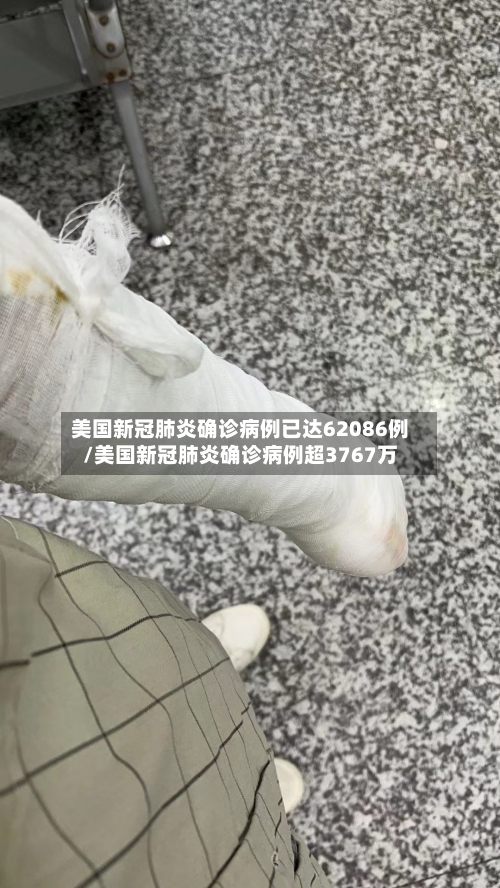 美国新冠肺炎确诊病例已达62086例/美国新冠肺炎确诊病例超3767万
