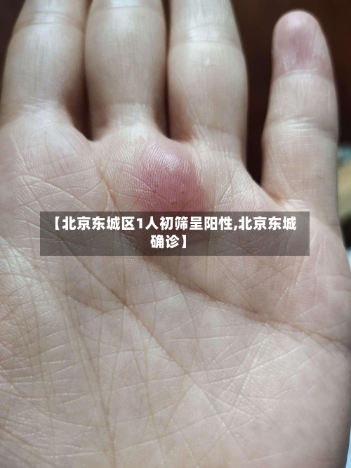 【北京东城区1人初筛呈阳性,北京东城确诊】-第2张图片