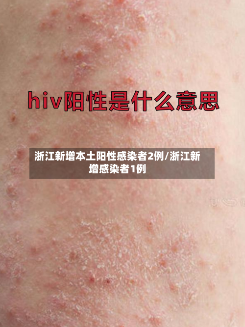 浙江新增本土阳性感染者2例/浙江新增感染者1例-第2张图片