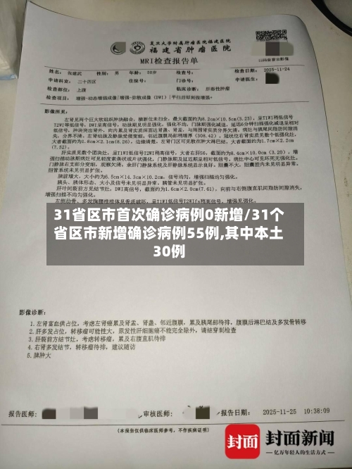 31省区市首次确诊病例0新增/31个省区市新增确诊病例55例,其中本土30例