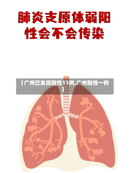 【广州已发现阳性11例,广州阳性一例】-第2张图片